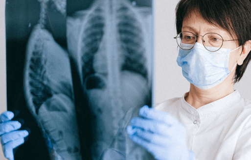Doctor wearing a mask examining two x-rays of someone's torso.